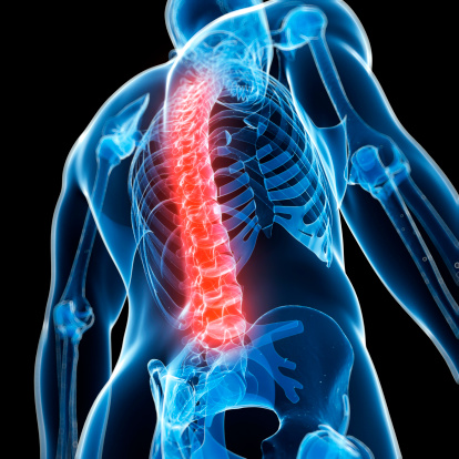 Nuevas esperanzas para las víctimas de lesiones de médula espinal 