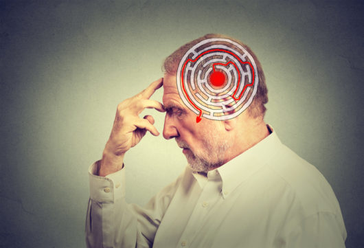 ¿Las lesiones cerebrales y el Alzheimer están conectados? 