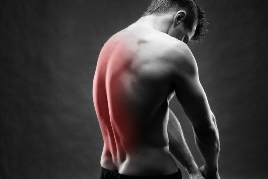 Los 3 tipos más comunes de lesiones de espalda causadas por accidentes de camiones