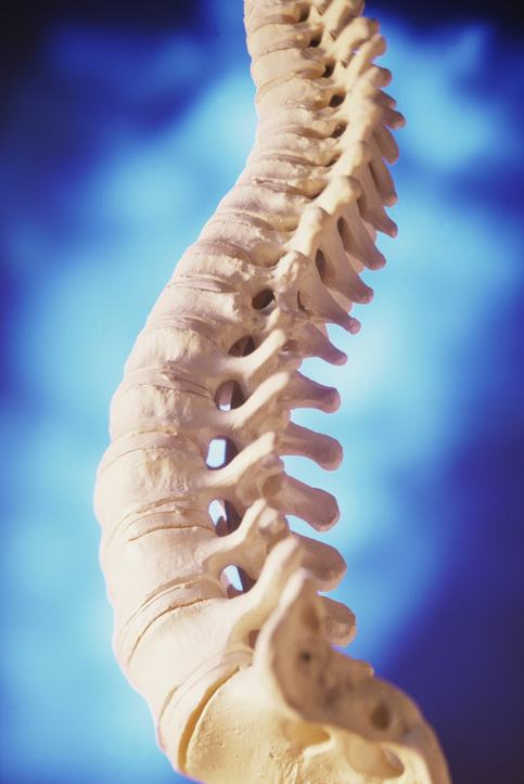 Un debate candente: ¿la cicatrización de la médula espinal es buena o mala para la recuperación?