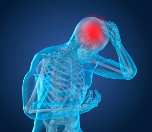 Una guía para comprender las lesiones cerebrales por golpe y contragolpe