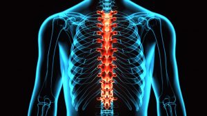 Los accidentes con camiones pueden resultar en lesiones graves de la médula espinal