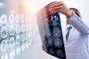 Lesiones cerebrales traumáticas: ¿Qué son y cuáles son los síntomas?