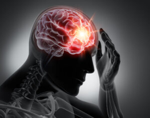 Descubra las tres causas más comunes de las lesiones cerebrales traumáticas