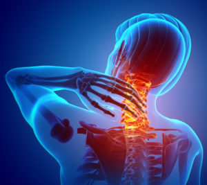 Los accidentes de coche pueden causar lesiones graves en el cuello: descubra cómo un abogado puede ayudarlo a recuperar una compensación por sus lesiones