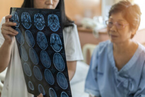 Un estudio sobre las consecuencias a largo plazo de las lesiones cerebrales plantea algunas preguntas impactantes
